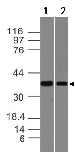 Polyclonal Rabbit anti-Human SIPR2 / S1P2 / EDG5 Antibody (WB)