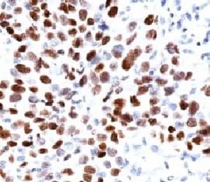CDKN1A / WAF1 / p21 Antibody (clone CIP1/823)