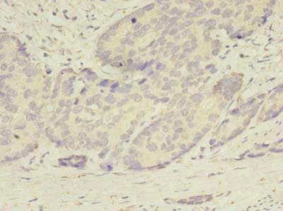 Polyclonal Rabbit anti-Human ATG2B Antibody (IHC)