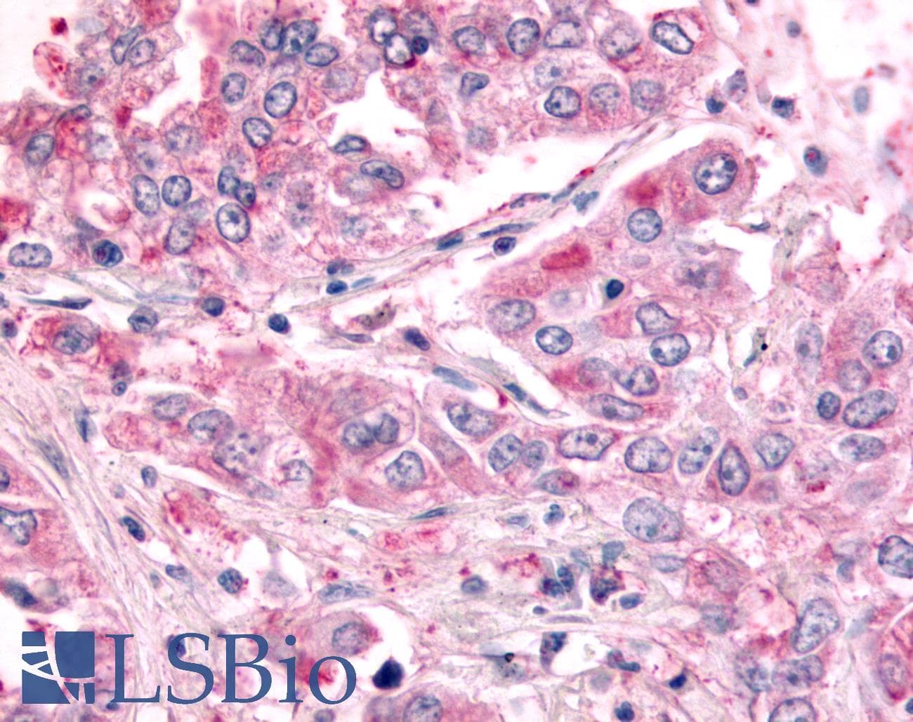 PathPlus™ SGK2 Antibody (Internal)