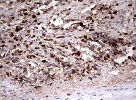 TOP2A / Topoisomerase II Alpha Antibody (aa1100-1531, clone OTI2A9)