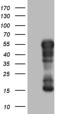 Monoclonal Mouse anti-Human BHLHE41 / BHLHB3 / SHARP1 Antibody (clone OTI4E1, aa1-297, IHC, WB)