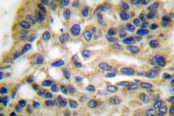 HSPD1 / HSP60 Antibody (Thr547)