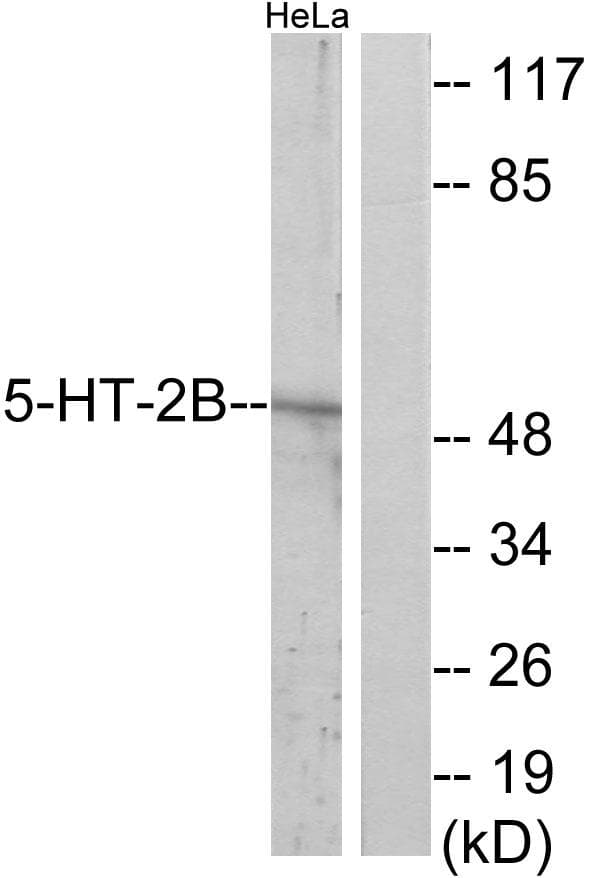 HTR2B / 5-HT2B Receptor Antibody