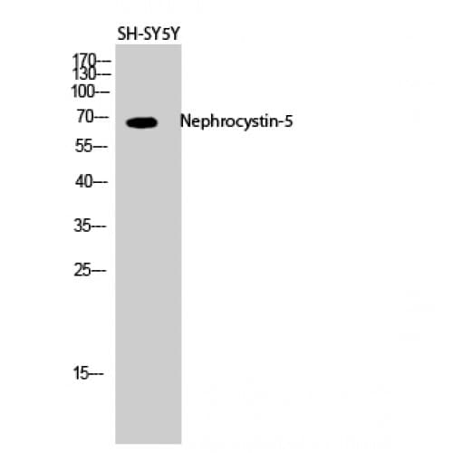 Polyclonal Rabbit anti-Human IQCB1 Antibody (400-480 aa, Internal, IHC, WB)