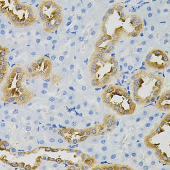 PFKP Antibody