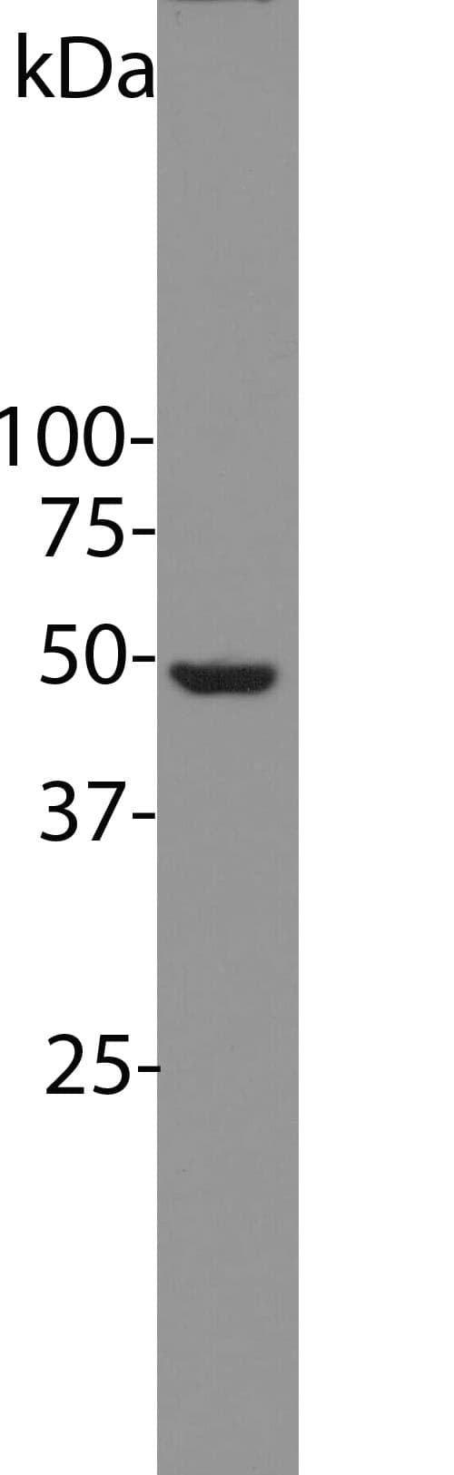 ENO1 / Alpha Enolase Antibody (clone 253)