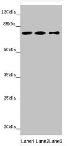 Polyclonal Rabbit anti-Human STXBP2 Antibody (WB)