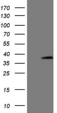 ASB8 Antibody (clone OTI1A6)