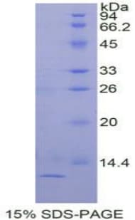 Human TGFA / TGF Alpha Protein (Recombinant His-T7)