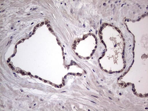 RAD23B / HR23B Antibody (aa1-253, clone OTI9F8)