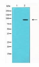 Polyclonal Rabbit anti-Human TLR4 Antibody (IHC, WB)