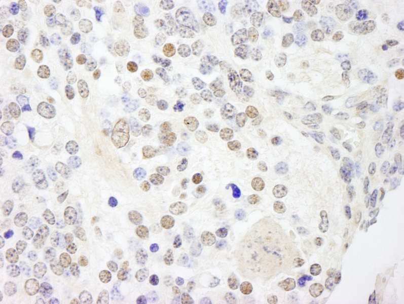 ANKS3 Antibody (aa606-656)