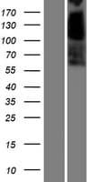 Carboxylesterase 3 / CES3 Protein (Over-Expression Lysate Myc-DDK (Flag))