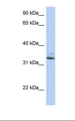 SULT1A1 / Sulfotransferase 1A1 Antibody (N-Terminus)