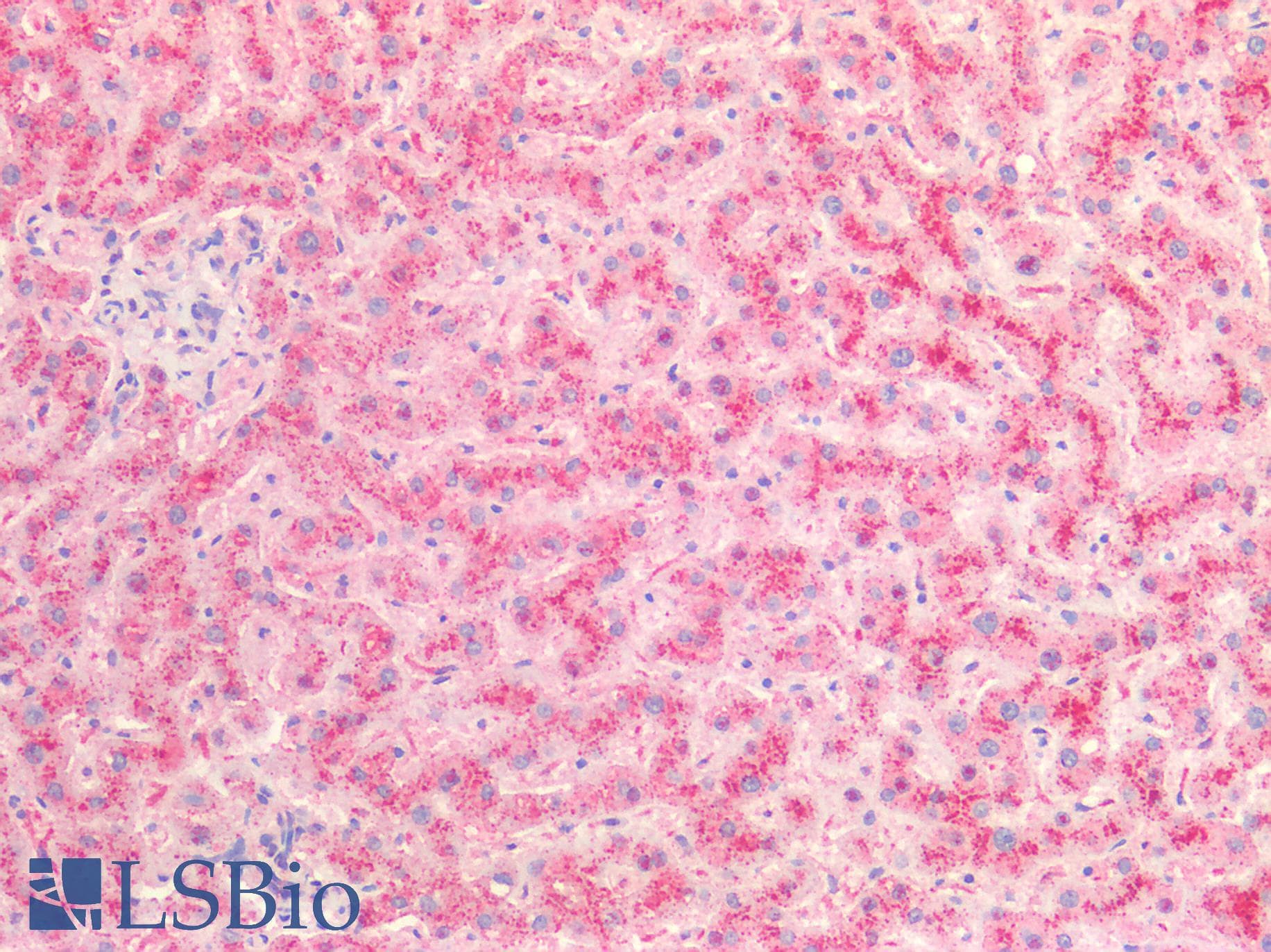IHC-plus™ CTSB / Cathepsin B Antibody