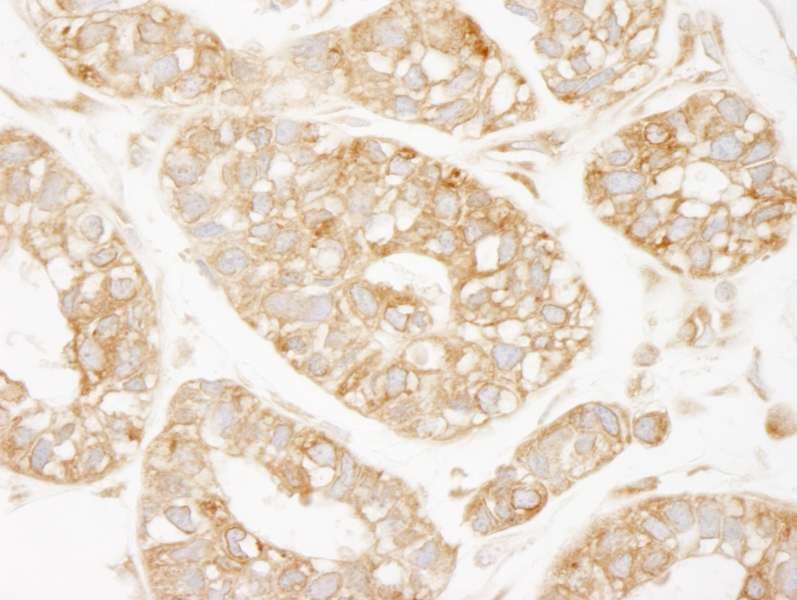 KARS Antibody (aa550-C-term)