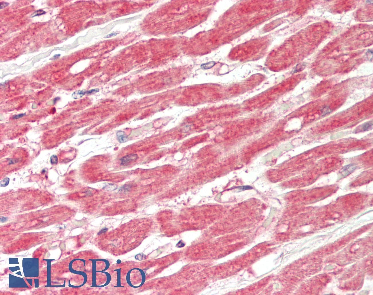 MTMR12 Antibody (C-Terminus)