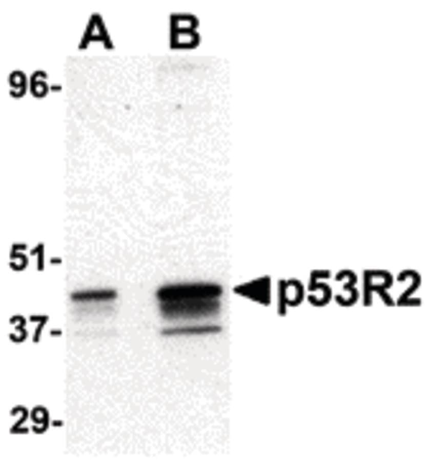 IHC-plus™ RRM2B / P53R2 Antibody