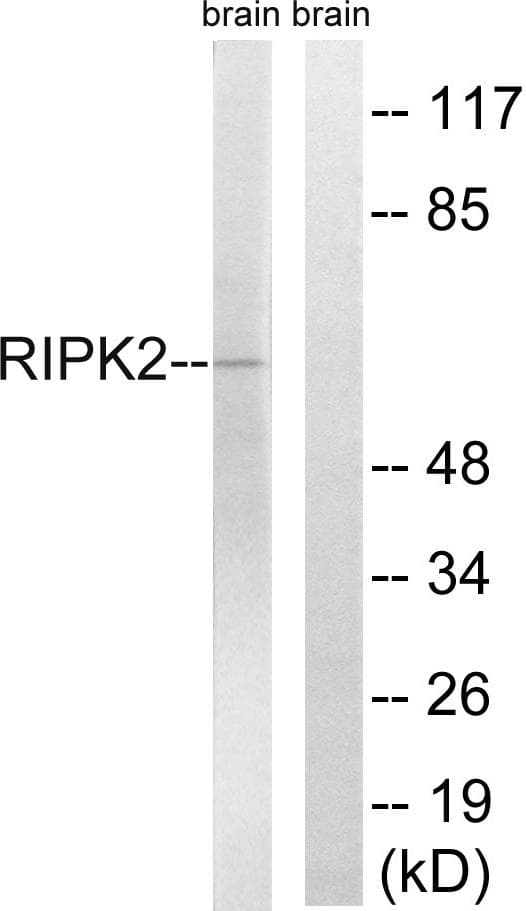 RICK / RIP2 Antibody (p176)