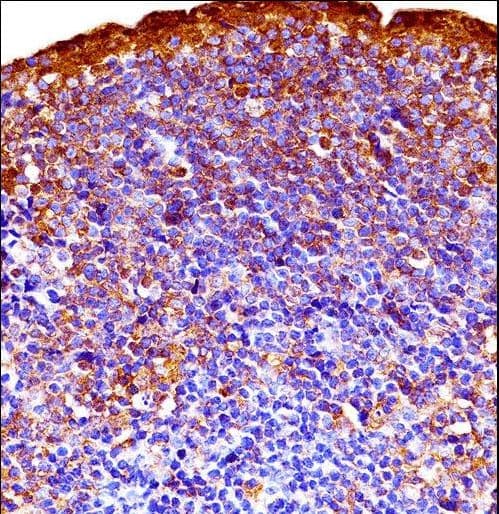 GSK3A / GSK3 Alpha Antibody (aa348-376)