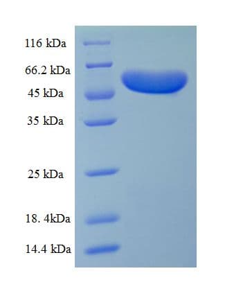 Chlamydia pneumoniae ompA Protein (Recombinant His-SUMO)