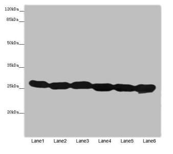 TMED10 / TMP21 Antibody