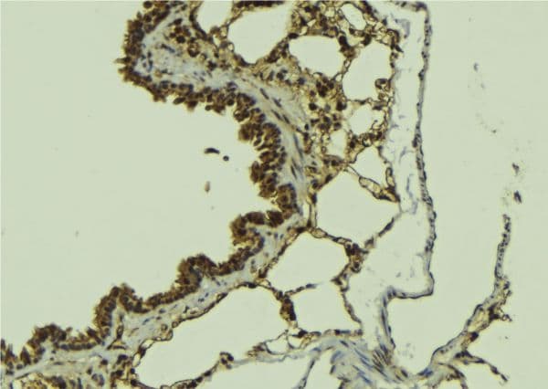 ATRIP Antibody