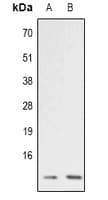 Polyclonal Rabbit anti-Human ATP5I Antibody (Internal, IHC, WB)