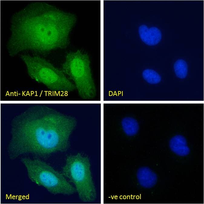 IHC-plus™ Polyclonal Goat anti-Human TRIM28 / KAP1 Antibody (aa823-835, IHC, IF)