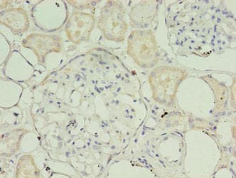 TIMM10B / FXC1 Antibody