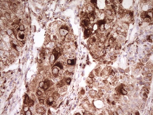 ERBB3 / HER3 Antibody (clone OTI1C6, Carrier-free)