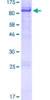 Human BIRC3 / cIAP2 Protein (Recombinant GST)