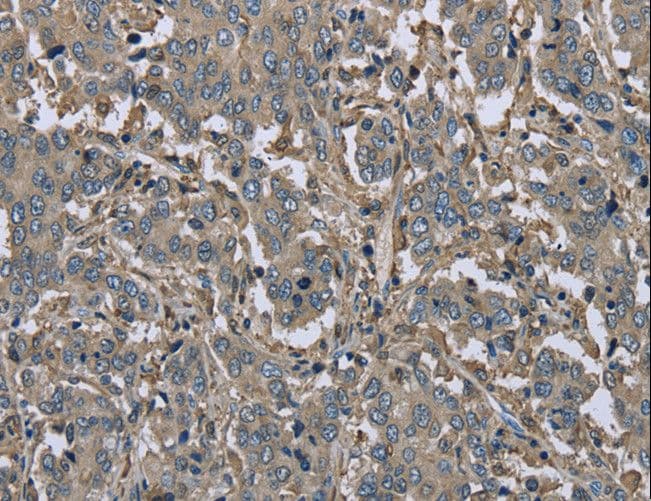FBP1 Antibody