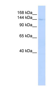 Polyclonal Rabbit anti-Human CIITA Antibody (C-Terminus, WB)