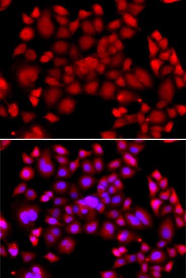 PIP4K2B Antibody