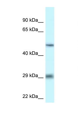 LIPH / Lipase Member H Antibody (aa259-308)