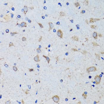 PTP1B Antibody