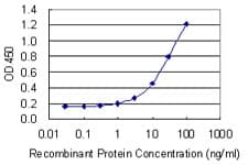 CA6 / Carbonic Anhydrase 6 Antibody (clone 1G12)