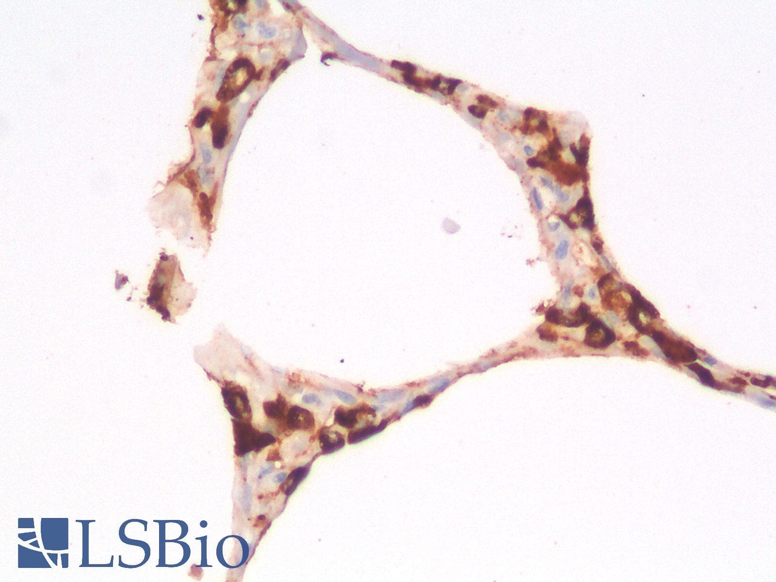 IHC-plus™ NAPSA / NAPA / Napsin A Antibody (aa189-299, clone rNAPSA/1239)