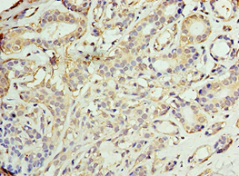 AKAP10 Antibody (aa413-662)