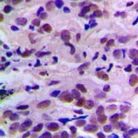 Polyclonal Rabbit anti-Human CDK2 Antibody (phospho-Thr160, IHC, WB)