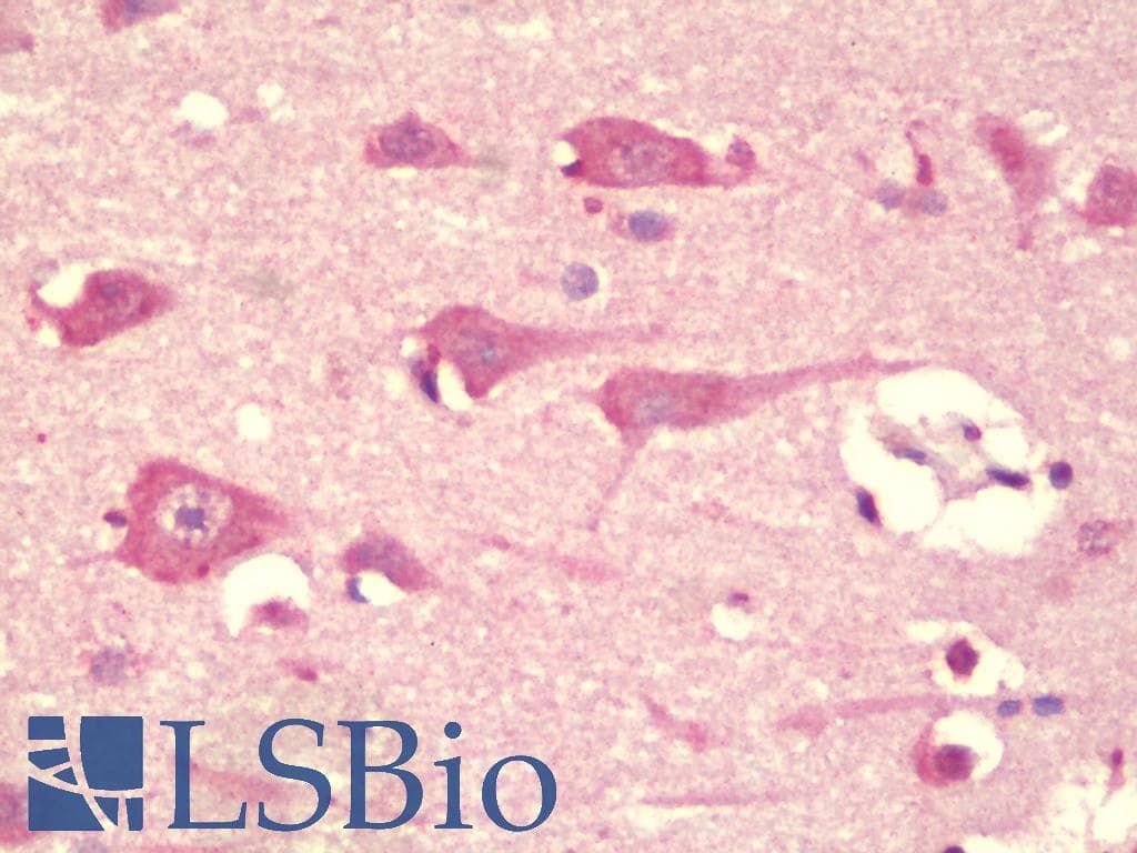 IHC-plus™ TMEM59L Antibody