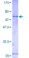Human PRSS50 / TSP50 Protein (Recombinant GST)