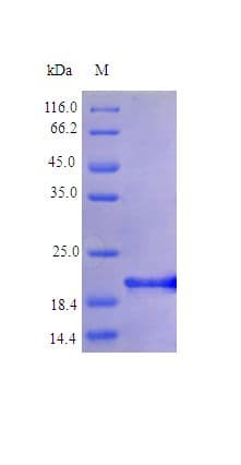 Human IL6 / Interleukin 6 Protein (Recombinant)