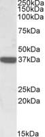 IHC-plus™ CNN3 Antibody (aa309-323)