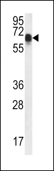 Polyclonal Rabbit anti-Human CCDC102A Antibody (aa401-430, IHC, WB)
