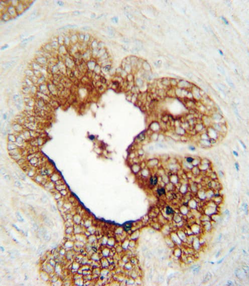 Polyclonal Rabbit anti-Human LAG3 Antibody (aa103-132, IHC, WB)