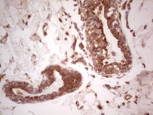 UBE2D2 / UBCH5B Antibody (clone OTI2C2)