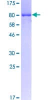 Human CAMK4 / CaMK IV Protein (Recombinant GST)
